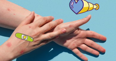deux bras avec du psoriasis
