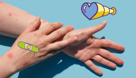 deux bras avec du psoriasis
