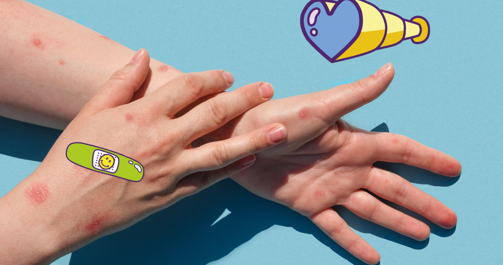deux bras avec du psoriasis